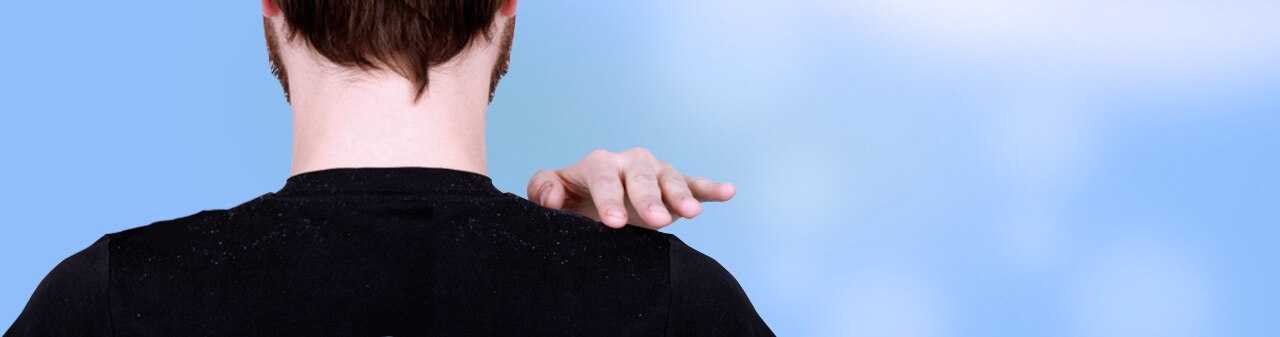 caspa o que e como trata la main banner caspa o que e como trata la main banner